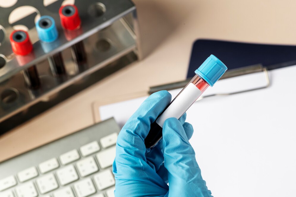 TST condena empresa por dispensar empregado com HIV